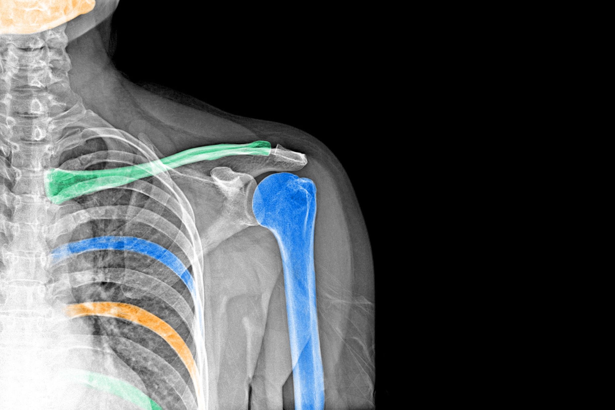 6 Facts About X-Rays: History and Uses