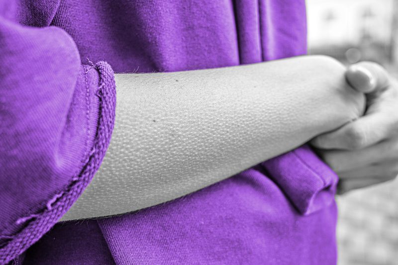 Why Do You Get Goosebumps When You’re Not Cold?